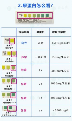 d3000测光结果怎么看-怎么看眼睛的测光结果